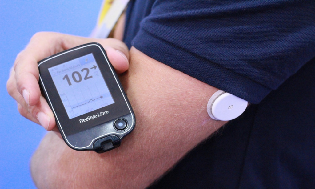 Nuevo sensor permitirá monitorear la glucosa de 1.8 millones de salvadoreños con diabetes 1 image 263
